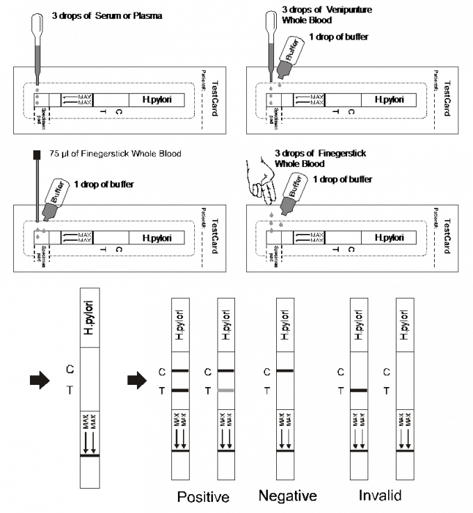 H.pyloriの抗体の側面流れImmunochromatographicはストリップ、全血/血清/血しょうを試金します