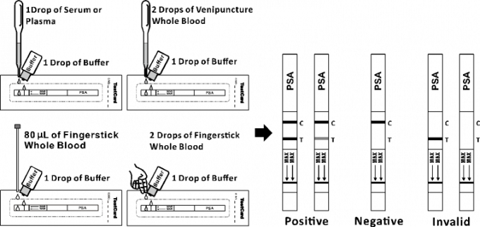 最高は前立腺の特定の抗原の(PSA)の証明されたセリウムが付いている質的で急速な診断キットの計深器を修飾しました