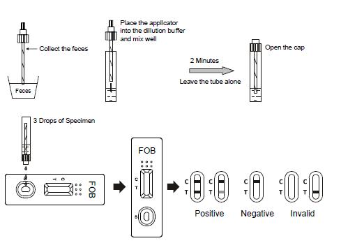 セリウムが付いているCryptosporidiumそしてGiardiaのLambliaのコンボの急速な診断試験