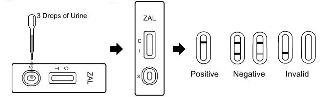 尿の乱用テスト キットの白い色100 NG/ML Zaleplon ZALの診断薬剤
