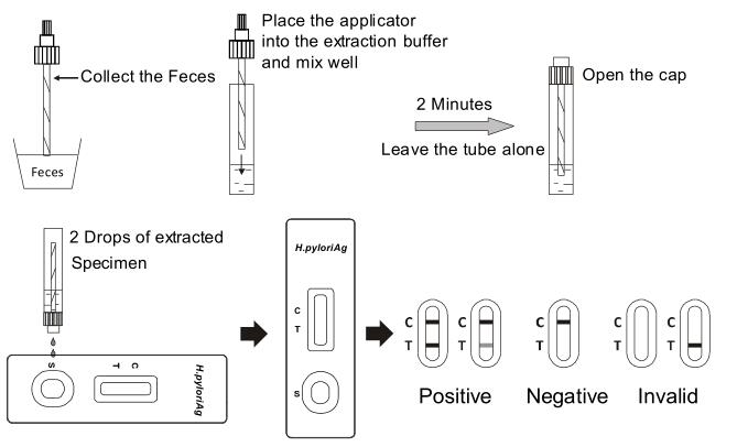 糞便 H.の幽門の抗原病院のための急速なテスト キットの人種の壁