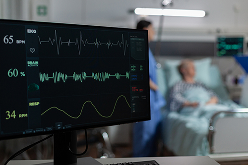 最新の企業ブログについて 心房 振動 (AFib) を 理解 する